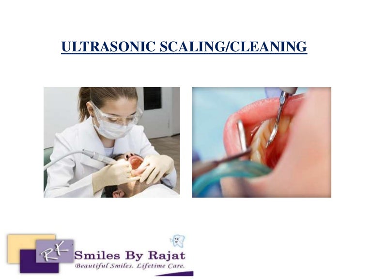 Ultrasonic scaling