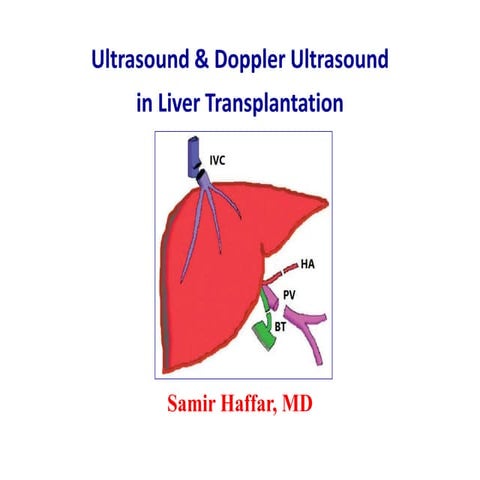 Ultrasound & doppler ultrasound in liver transplantation