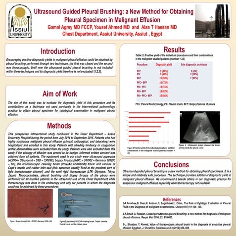 ERS London 2016: Poster Discussion:Ultrasound Guided Pleural Brushing: a New ...