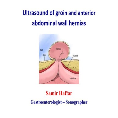 Ultrasound of groin & anterior abdominal wall hernias