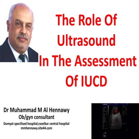 Role Of Ultrasound in assessment of  iucd