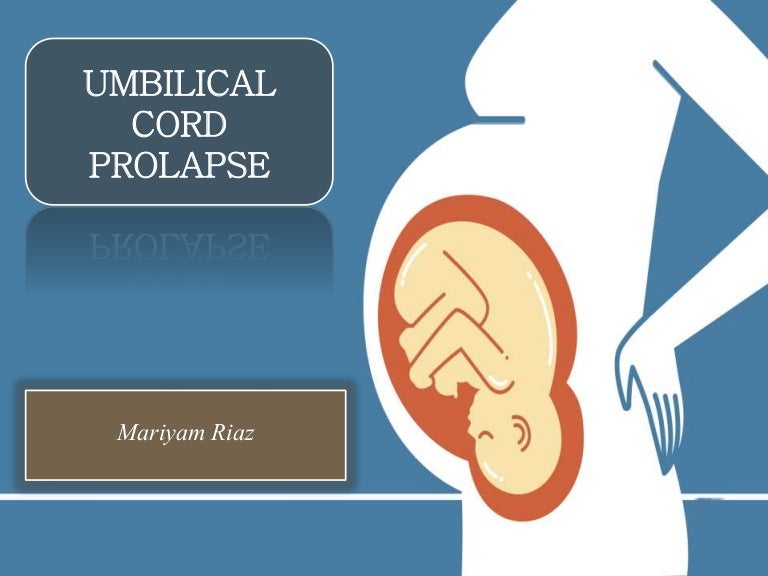 umbilical cord prolapse prolapsed cord