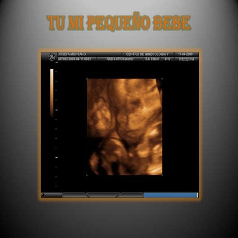 Una historia de amor