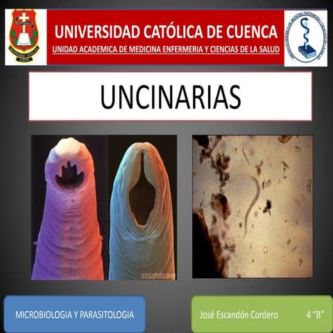 Uncinarias