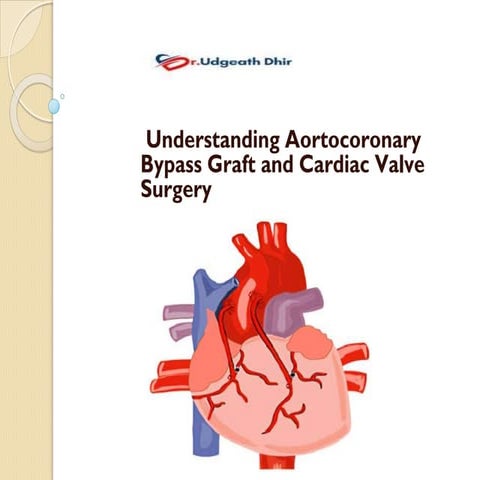 CABG | PPTX