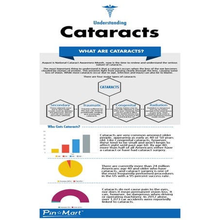 Understanding Cataracts