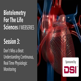 Don't Miss a Beat:  Understanding C...