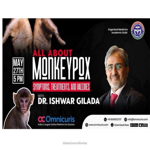 Understanding Monkeypox