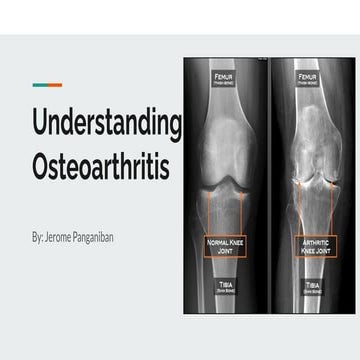 The Role of Physiotherapy in Osteoarthritis Management | PPTX