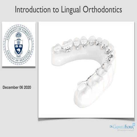 Introduction to Lingual Orthodontics - Toronto University