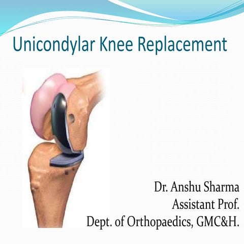 Unicondylar knee replacement