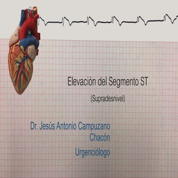 Unidad 9 segmento st