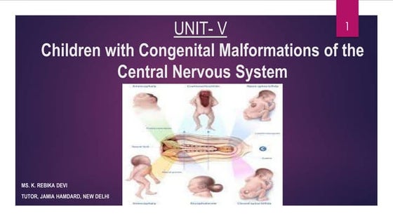 Congenital Anomalies of Nervous System | PPT