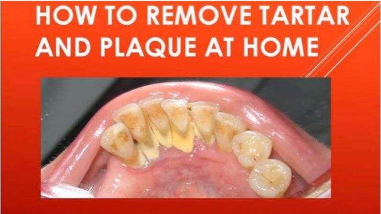 How To Remove Plaque And Tartar At Home 