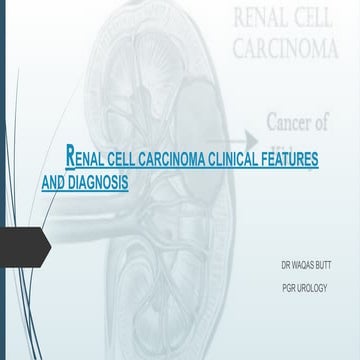 Renal cell carcinoma | PPTX