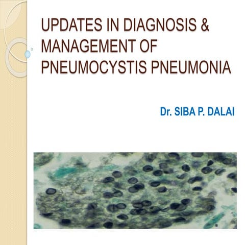 pneumocystis pneumonia 