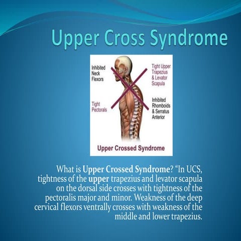 Upper cross syndrome