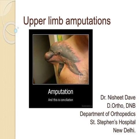 Upper Limb Amputations