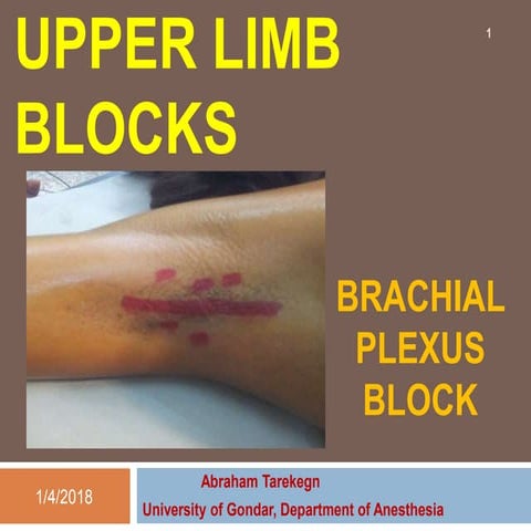 Upper limb blocks 