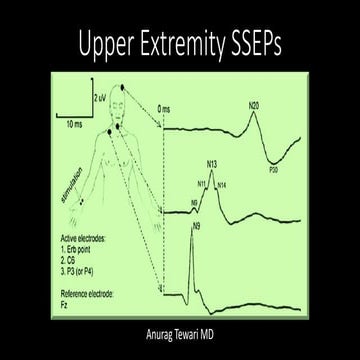 Upper Extremity Somatosensory Evoked Potential (Upper SSEP)