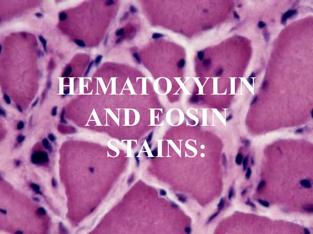 hematoxylin and eosin stains