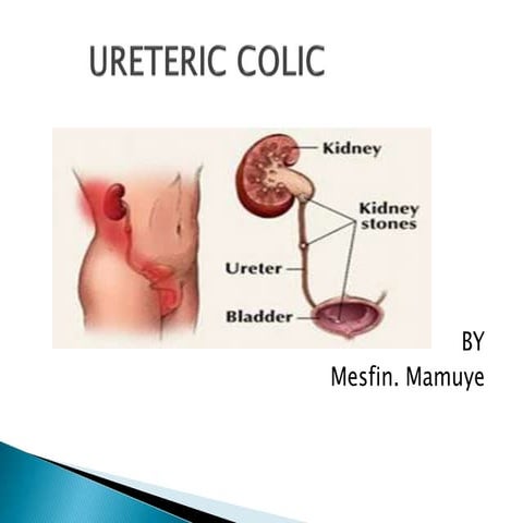 Ureteric colic