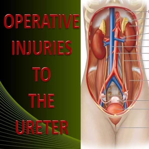 Ureteric injury ppt Dr. Neha Jain, JNMCH, AMU, Aligarh