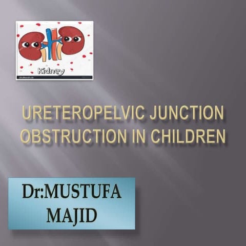Ureteropelvic junction obstruction in children