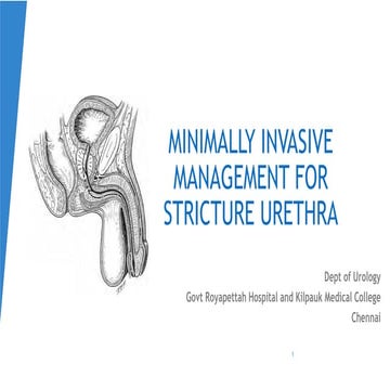 Urethra stricture  management- minimally invasive
