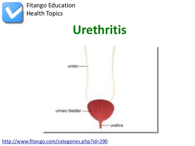 Urethritis