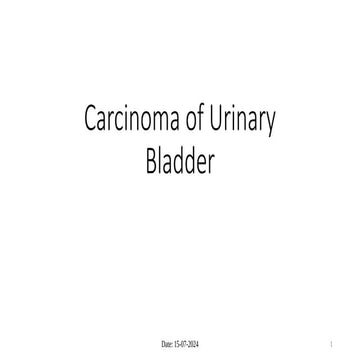 Urinary bladder carcinoma - for bs upload.pptx