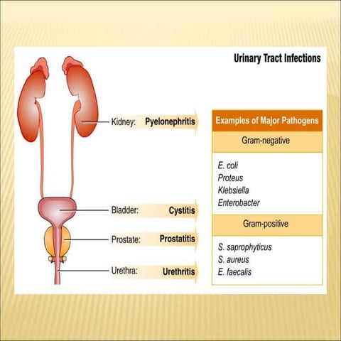 Uti ( pharmacology) | PPTX