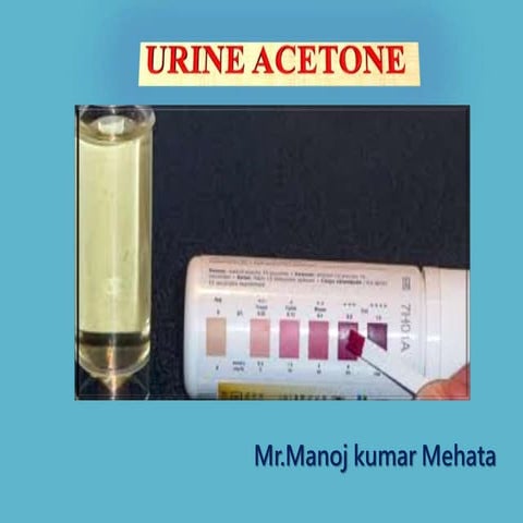 Urine acetone