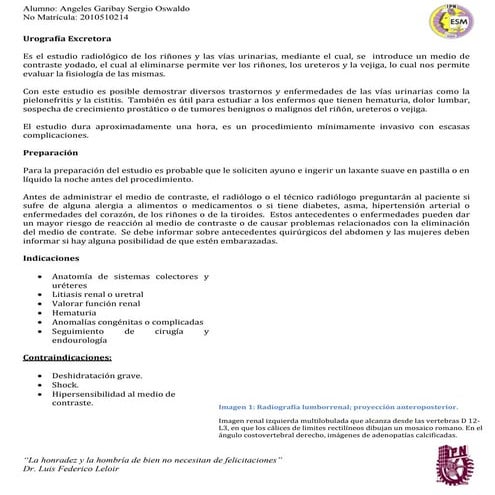 Urografía Excretora