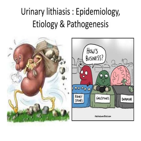 Urolithiasis
