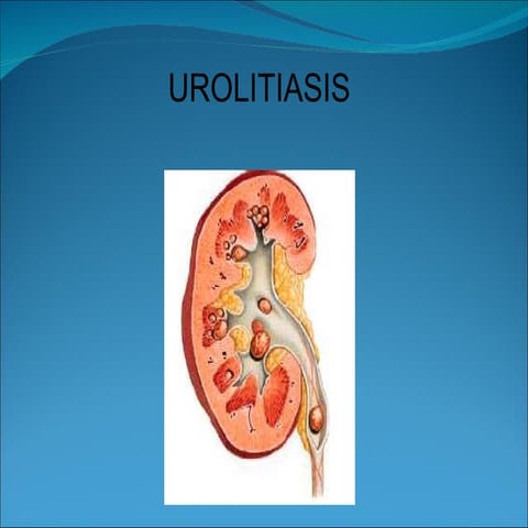 Urolitiasis