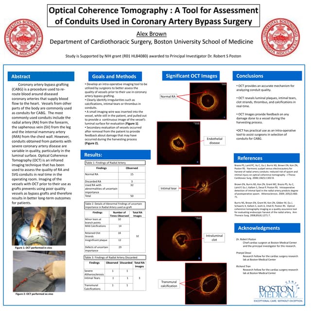 OCT ANGIOGRAPHY | DOCX