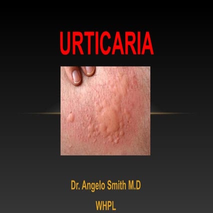 Urticaria