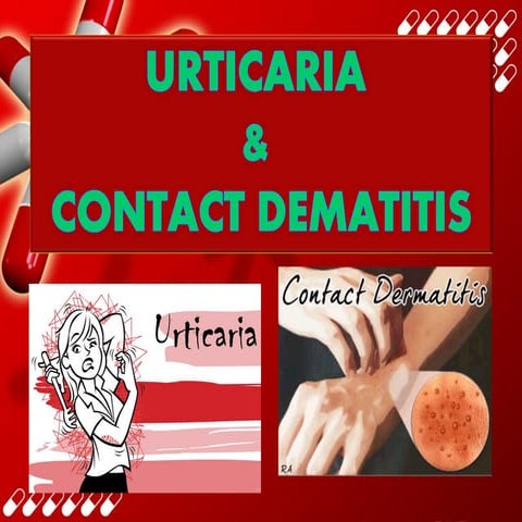 URTICARIA AND CONTACT DERMATITS-MEDICAL-BIOMEDICAL-MATHANKUMAR S
