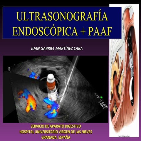 Use paaf ephp | PPT