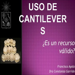 Uso de cantilevers
