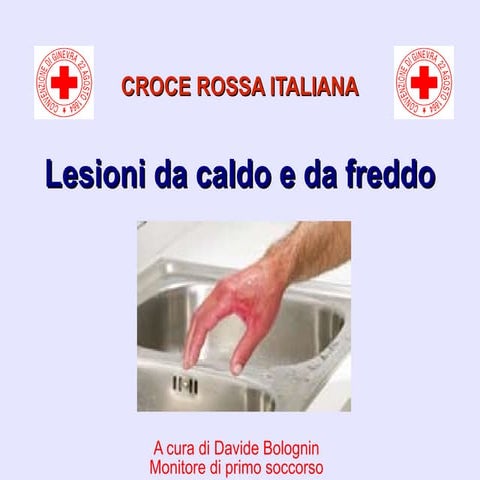 Ustioni primo-soccorso