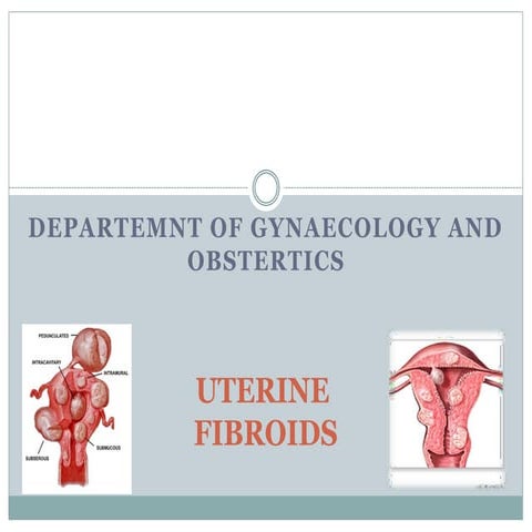 MYOMA OF UTERUS.pptx