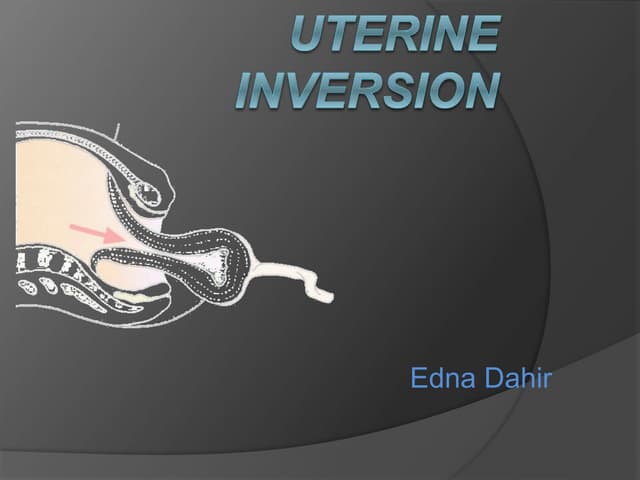 Inversion of the uterus | PPT