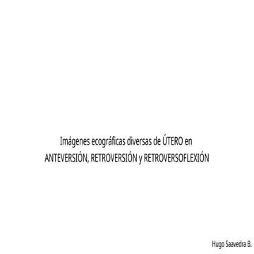 Utero en anteversion y retroversion_Tarea Ecografía_HSB_pptx.pptx