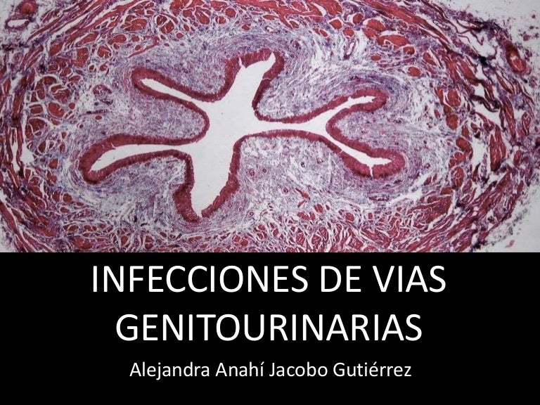 cistitis de vejiga granulomatosa después de prostatitis
