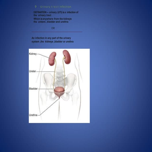 Urinary tract infection | PPTX