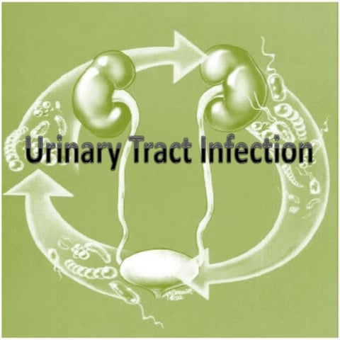 UTI- Urinary Tract Infection | PPT