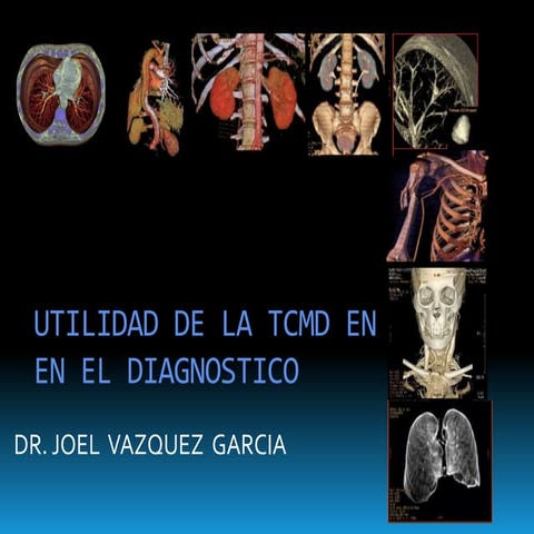 Malformaciones vasculares cerebrales | PPTX