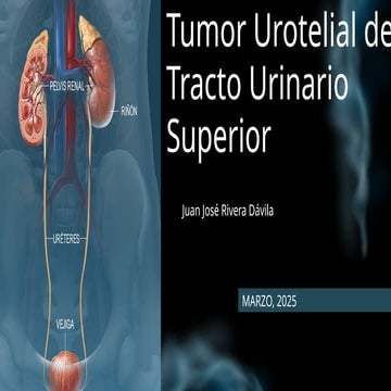 Carcinoma Urotelial de Tracto Urinario Superior UTUC.pptx